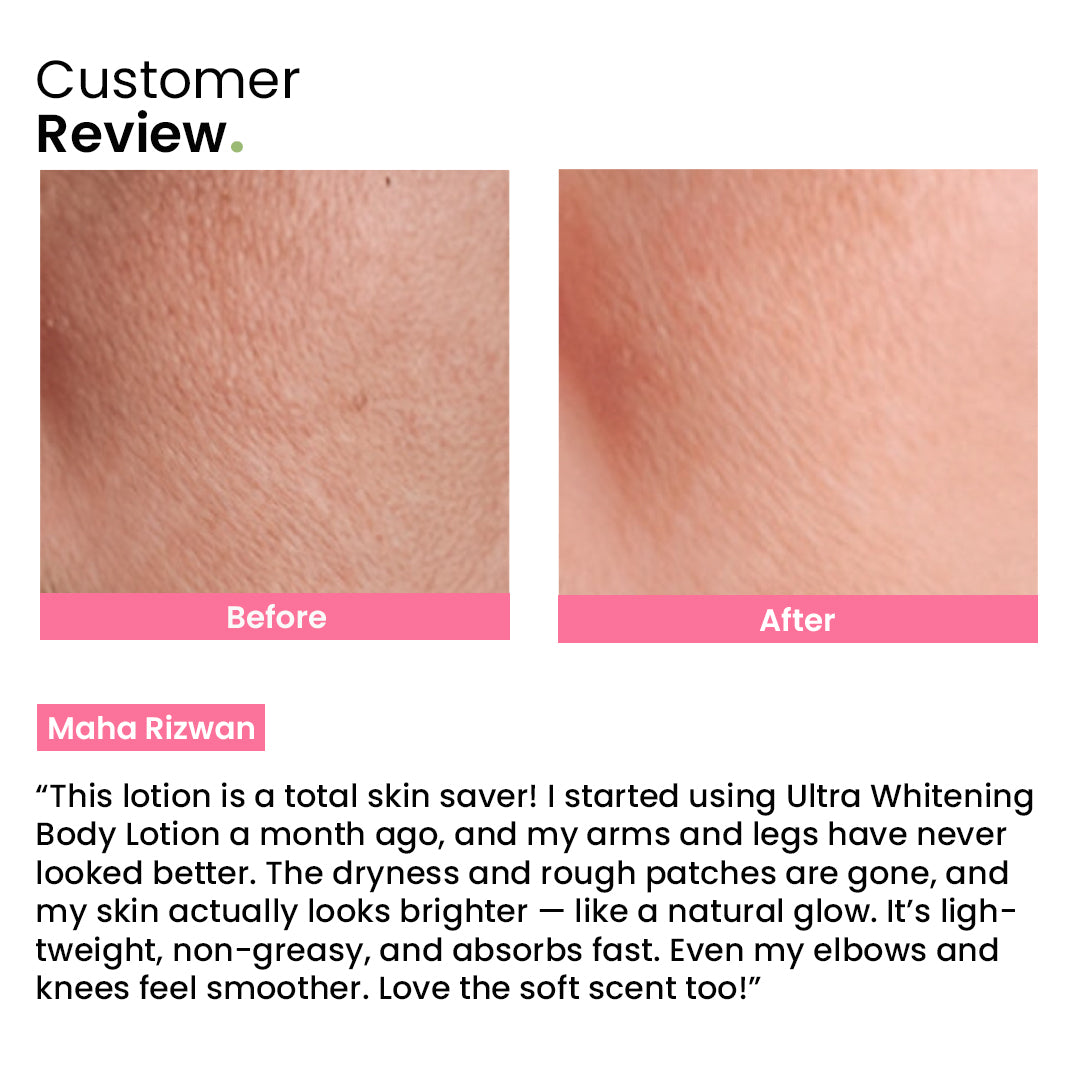 Ultra Whitening Body Lotion