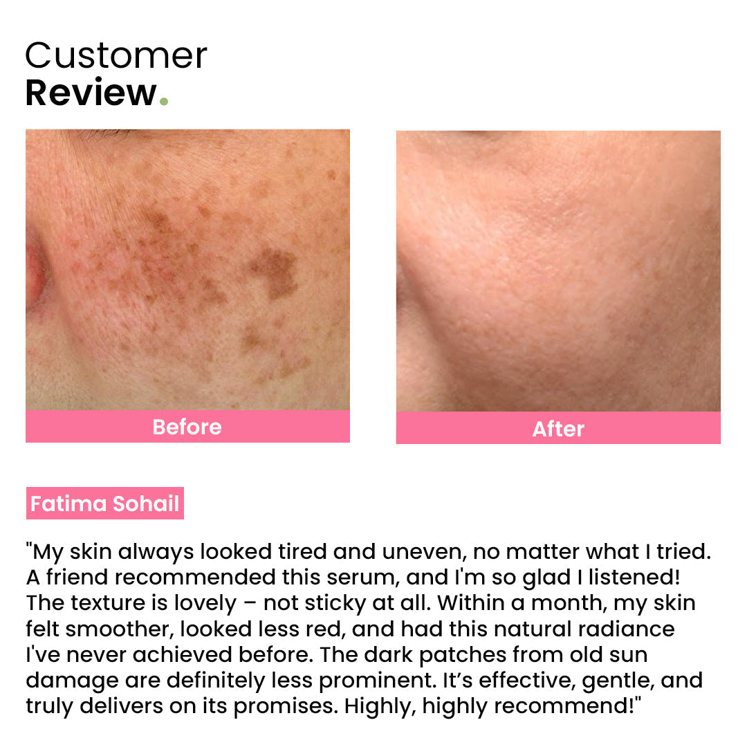 Ultra Whitening Serum