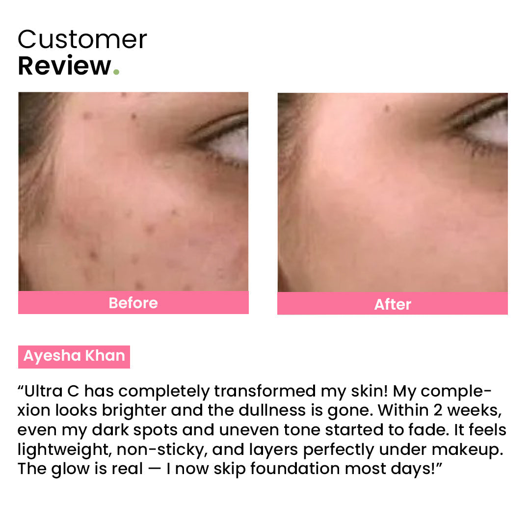 Ultra C: Vitamin C Serum